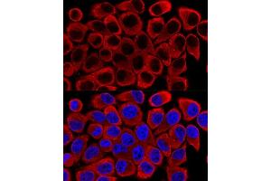 Immunofluorescence (IF) image for anti-Sequestosome 1 (SQSTM1) (AA 1-440) antibody (ABIN6148419)