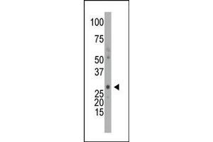 The anti-DCK Pab (ABIN391125 and ABIN2841251) is used in Western blot to detect DCK in mouse intestine tissue lysate. (DCK 抗体  (C-Term))