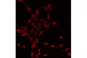 ABIN6272269 staining HeLa by IF/ICC. (CTNNA2 抗体  (C-Term))