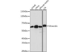 Western blot analysis of extracts of various cell lines, using Vimentin antibody (ABIN7271326) at 1:1000 dilution. (Vimentin 抗体)