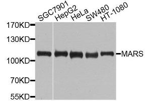 Western blot analysis of extracts of various cell lines, using MARS antibody (ABIN6003646) at 1/1000 dilution. (Mars (MARS) 抗体)