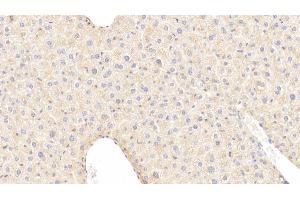 Detection of IGFBP4 in Mouse Liver Tissue using Polyclonal Antibody to Insulin Like Growth Factor Binding Protein 4 (IGFBP4) (IGFBP4 抗体  (AA 22-254))