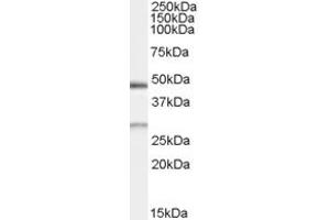 Western Blotting (WB) image for anti-BCL2/adenovirus E1B 19kDa Interacting Protein 1 (BNIP1) (AA 162-176) antibody (ABIN295942) (BNIP1 抗体  (AA 162-176))