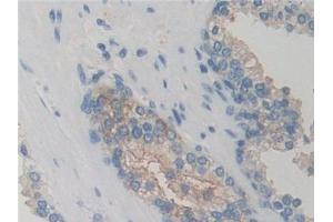 IHC-P analysis of Human Prostate Tissue, with DAB staining. (GRK6 抗体  (AA 186-448))