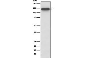 Western blot analysis of SMC3 expression in HeLa cell lysate.