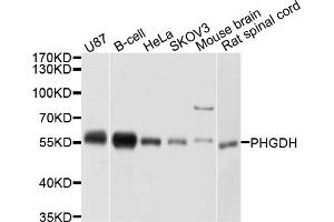Western blot analysis of extracts of various cell lines, using PHGDH antibody (ABIN5998506) at 1/1000 dilution. (PHGDH 抗体)