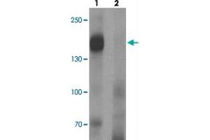 Western blot analysis of LNPEP in human lung tissue with LNPEP polyclonal antibody  at 1 ug/mL in (1) the absence and (2) the presence of blocking peptide. (LNPEP 抗体  (C-Term))