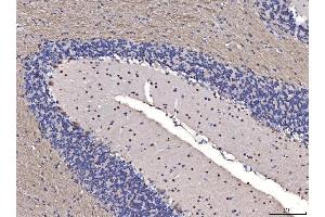 IHC analysis of FGF2 using anti-FGF2 antibody (ABIN7603215). (FGF2 抗体  (N-Term))