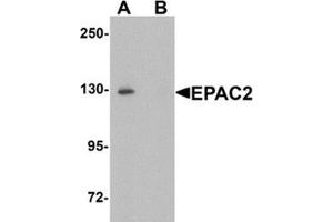 Western blot analysis of EPAC2 in rat liver tissue lysate with EPAC2 Antibody at 1 μg/ml in (A) the absence and (B) the presence of blocking peptide. (RAPGEF4 抗体  (N-Term))