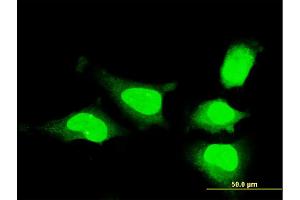 Immunofluorescence (IF) image for anti-Musashi Homolog 1 (Drosophila) (MSI1) (AA 1-87) antibody (ABIN518033)