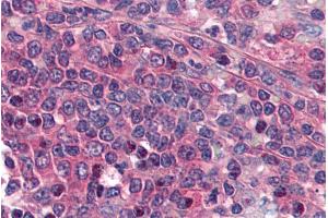 Immunohistochemistry (IHC) image for anti-Prostaglandin E Receptor 1 (Subtype EP1), 42kDa (PTGER1) (Internal Region) antibody (ABIN185589)