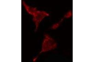 ABIN6278562 staining  HeLa cells by IF/ICC. (CTBP2 抗体  (C-Term))