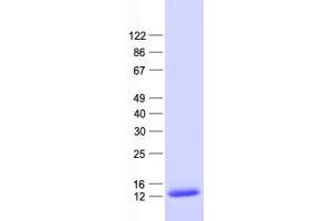 Validation with Western Blot