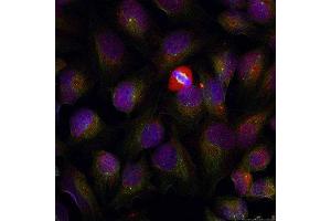 Immunofluorescence (IF) image for anti-Nuclear Factor of kappa Light Polypeptide Gene Enhancer in B-Cells 1 (NFKB1) (pSer337) antibody (ABIN3019578)