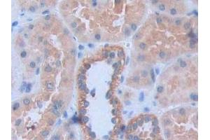 Immunohistochemistry (IHC) image for anti-Heart and Neural Crest Derivatives Expressed 1 (HAND1) (AA 1-215) antibody (ABIN7443566)
