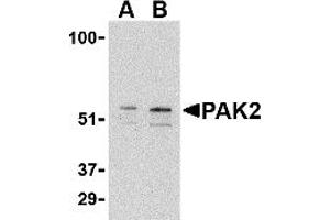Western Blotting (WB) image for anti-P21-Activated Kinase 2 (PAK2) (C-Term) antibody (ABIN1030567)