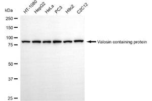 Western blotting analysis using valosin containing protein antibody (ABIN7800819).