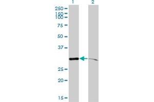 Western Blotting (WB) image for anti-Proteasome Subunit alpha Type 1 (PSMA1) (AA 1-263) antibody (ABIN562469)