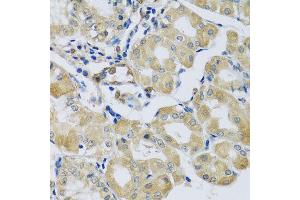 Immunohistochemistry of paraffin-embedded human stomach using SYT11 antibody at dilution of 1:100 (x40 lens). (SYT11 抗体)