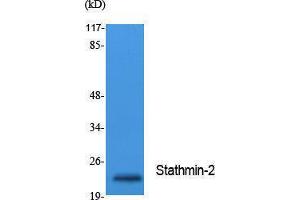 Western Blotting (WB) image for anti-Stathmin-Like 2 (STMN2) (Internal Region) antibody (ABIN3187637) (STMN2 抗体  (Internal Region))