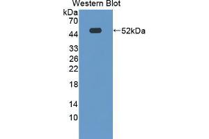 Western blot analysis of the recombinant protein. (NEXN 抗体  (AA 421-607))
