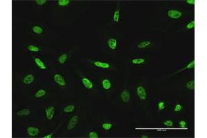 Immunofluorescence of purified MaxPab antibody to GTF3C2 on HeLa cell. (GTF3C2 抗体  (AA 1-911))
