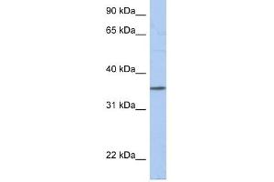 PRR18 antibody used at 1 ug/ml to detect target protein. (Proline Rich 18 抗体  (N-Term))