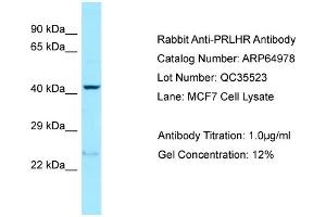 Western Blotting (WB) image for anti-Prolactin Releasing Hormone Receptor (PRLHR) (N-Term) antibody (ABIN2774413) (PRLHR 抗体  (N-Term))