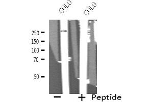 Western blot analysis of extracts from COLO cells, using MEGF8 antibody. (MEGF8 抗体  (Internal Region))