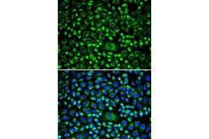 Immunofluorescence (IF) image for anti-TAP Binding Protein (Tapasin) (TAPBP) antibody (ABIN1875423) (TAPBP 抗体)