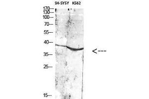 Western Blot (WB) analysis of specific cells using Antibody diluted at 1:1000. (ART1 抗体)