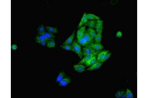 Immunofluorescent analysis of HepG2 cells using ABIN7170659 at dilution of 1:100 and Alexa Fluor 488-congugated AffiniPure Goat Anti-Rabbit IgG(H+L) (FDFT1 抗体  (AA 2-417))