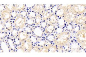 Detection of PAI1 in Human Kidney Tissue using Monoclonal Antibody to Plasminogen Activator Inhibitor 1 (PAI1)