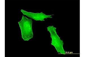 Immunofluorescence of monoclonal antibody to HRSP12 on HeLa cell. (HRSP12 抗体  (AA 1-137))