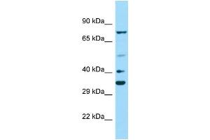 Host: Rabbit Target Name: PAX2 Sample Type: MCF7 Whole Cell lysates Antibody Dilution: 1. (PAX2A 抗体  (Middle Region))