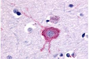 Anti-GRM2 / MGLUR2 antibody  ABIN1048928 IHC staining of human brain, neurons and glia. (GRM2 抗体  (N-Term))