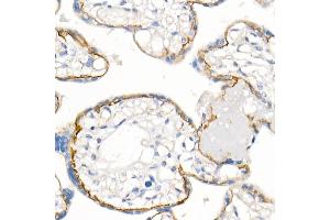 Immunohistochemistry (IHC) image for anti-Catenin (Cadherin-Associated Protein), delta 1 (CTNND1) antibody (ABIN7266144)