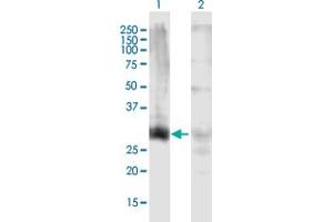 Western Blot analysis of HOXD13 expression in transfected 293T cell line by HOXD13 MaxPab polyclonal antibody. (Homeobox D13 抗体  (AA 1-343))