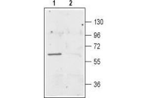 Western Blotting (WB) image for anti-Solute Carrier Family 1 (Neuronal/epithelial High Affinity Glutamate Transporter, System Xag), Member 1 (SLC1A1) (Intracellular) antibody (ABIN7043667)