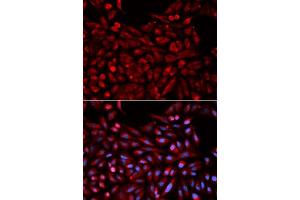 Immunofluorescence analysis of U2OS cells using NR1I3 antibody. (NR1I3 抗体  (AA 103-352))
