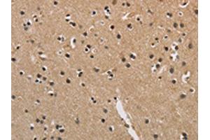 The image is immunohistochemistry of paraffin-embedded Human brain tissue using ABIN7128907(CENPN Antibody) at dilution 1/70. (CENPN 抗体)