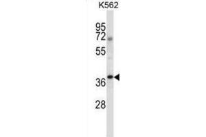 Western Blotting (WB) image for anti-NCK Adaptor Protein 1 (NCK1) antibody (ABIN2997496) (NCK1 抗体)