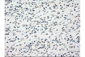 Image no. 2 for anti-Checkpoint Kinase 2 (CHEK2) antibody (ABIN1497495) (CHEK2 抗体)