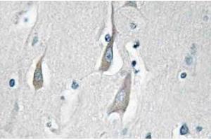 Immunohistochemistry (IHC) analyzes of p-CaMKIIalpha/delta antibody in paraffin-embedded human brain tissue. (CAMK2A 抗体  (pThr286))
