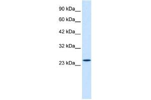 WB Suggested Anti-ZNF22 Antibody Titration:  1. (Zinc Finger Protein 22 抗体  (C-Term))