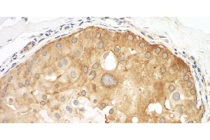 Immunohistochemistry (IHC) image for anti-Septin 9 (SEPT9) (AA 100-150) antibody (ABIN7453779)