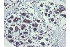 Image no. 8 for anti-TSC22 Domain Family, Member 1 (TSC22D1) antibody (ABIN1501540)