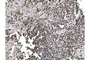 IHC analysis of Astrin/Deepest/SPAG5 using anti-Astrin/Deepest/SPAG5 antibody (ABIN7602399). (SPAG5 抗体  (AA 738-1193))
