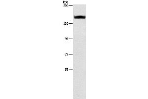 Western Blot analysis of A431 cell using ITGA2 Polyclonal Antibody at dilution of 1:300 (ITGA2 抗体)