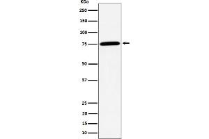 Western blot analysis of PPM1G expression in Jurkat cell lysate. (Recombinant PPM1G 抗体)